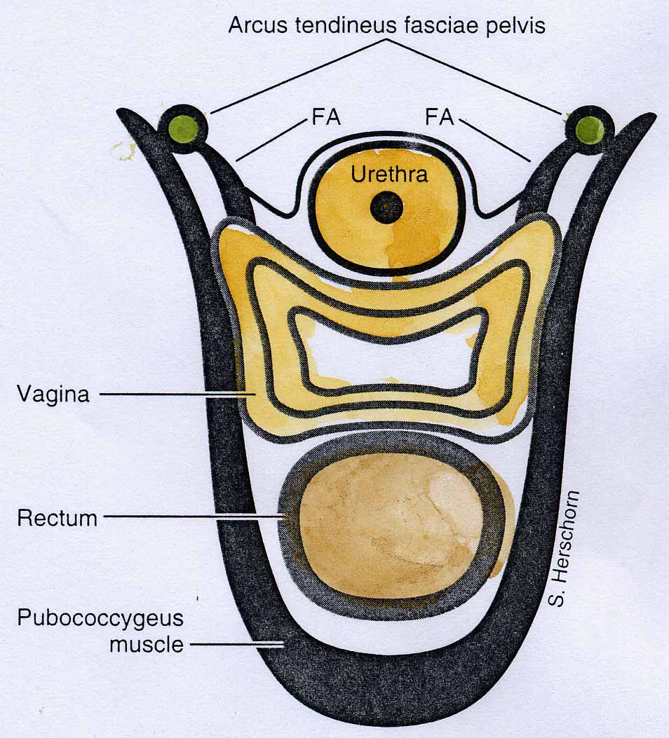 盆底肌修復(fù)|盆底肌的結(jié)構(gòu)特點(diǎn)和容易損傷的原因是什么？