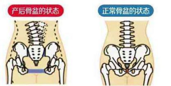 骨盆修復(fù) 骨盆修復(fù)