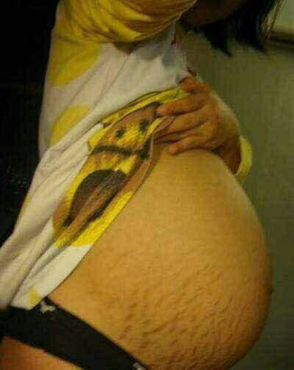 盆底康復(fù) 盆底康復(fù)