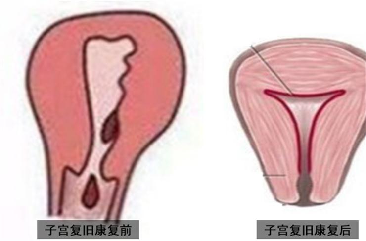 1560504216807356.jpg 產(chǎn)后盆底修復(fù)