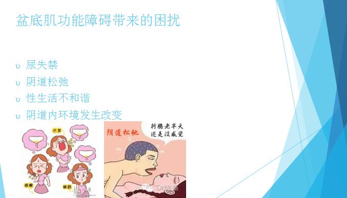 1563173311192195.jpg 盆底肌功能障礙