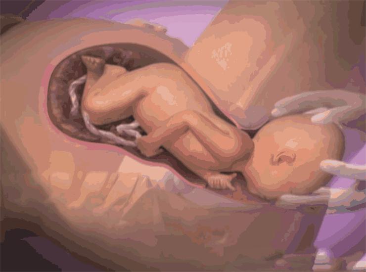 1563258164333790.jpg 產(chǎn)后盆底肌治療