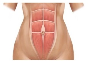 1565849787589866.jpg 腹直肌分離