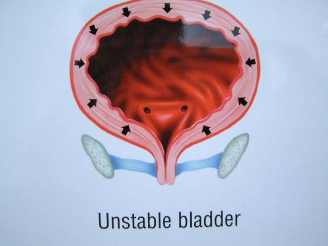 1568947587797999.png 盆底肌檢測