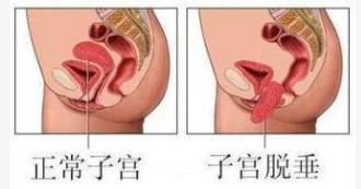 1570498297200144.png 產(chǎn)后康復(fù)治療