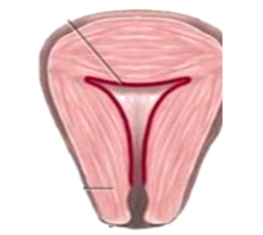 1571714478391289.jpg 子宮復舊