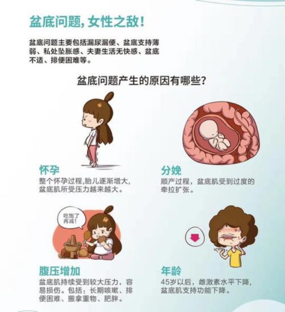 1572072057703670.jpg 盆底肌修復(fù)