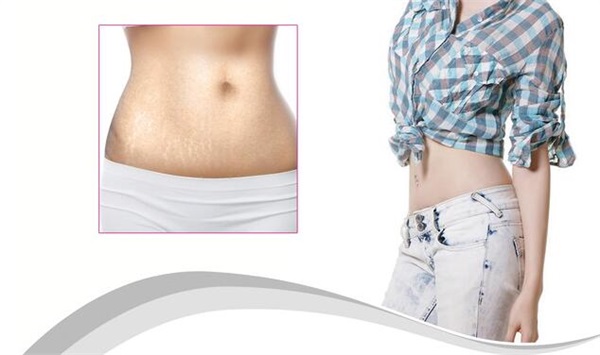 1573632610138518.jpg 產(chǎn)后修復(fù)治療