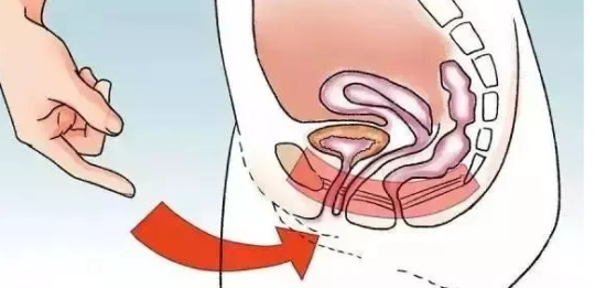 1578538357532036.png 凱格爾運(yùn)動(dòng)