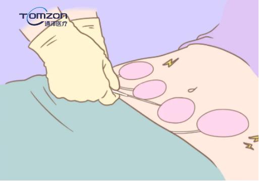 盆底肌修復(fù)儀器 盆底肌修復(fù)儀器