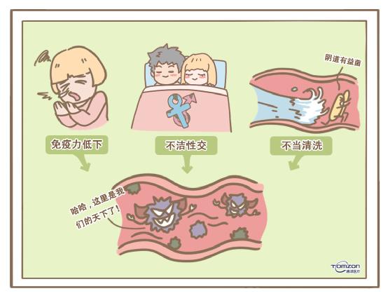 盆底康復(fù)治療儀.jpg 盆底康復(fù)治療儀.jpg