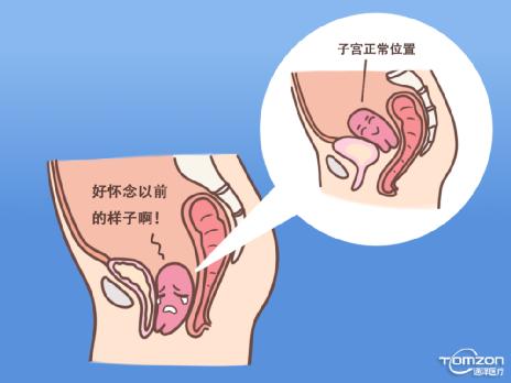 產后康復治療儀 產后康復治療儀