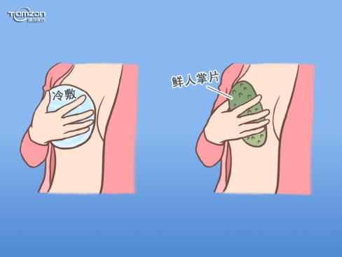 盆底治療儀 盆底治療儀