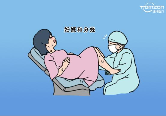 盆底肌修復儀器 盆底肌修復儀器