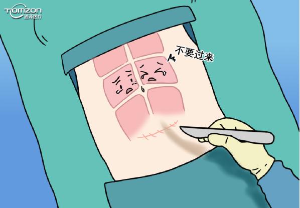 盆底肌修復(fù)儀器 盆底肌修復(fù)儀器