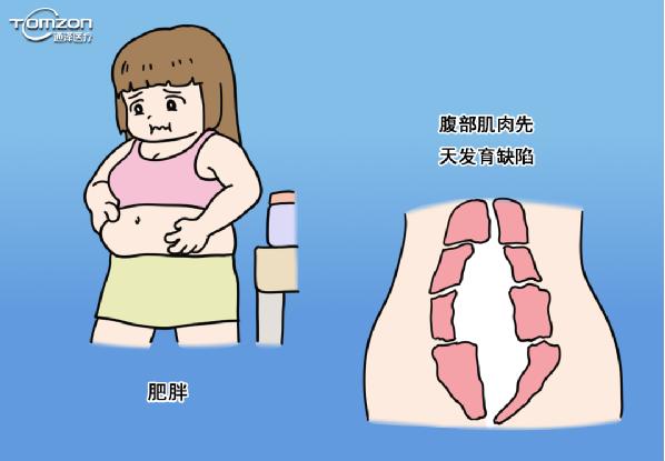 盆底肌修復(fù)儀器 盆底肌修復(fù)儀器